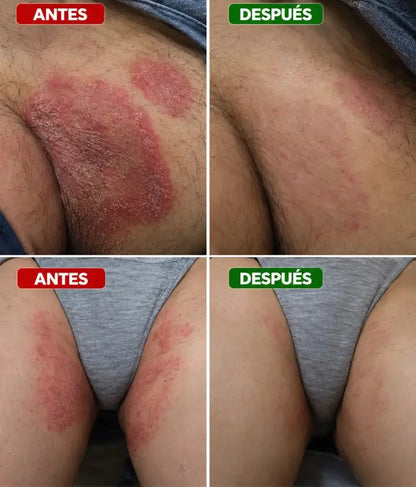 umex Bálsamo Reparador